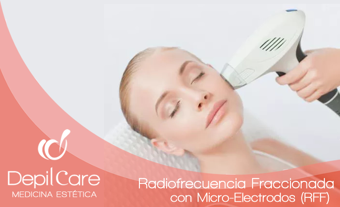RADIOFRECUENCIA FRACCIONADA CON MICRO-ELECTRODOS (RFF)